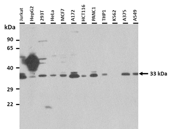 ASGR1 Rabbit Polyclonal Antibody