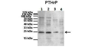 PTHLH antibody