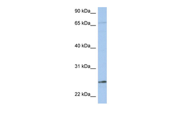 KLK6 antibody