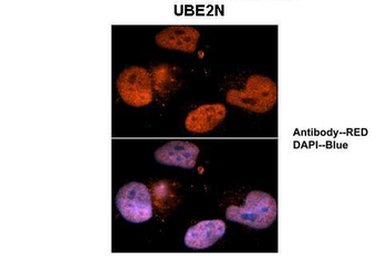 UBE2N antibody