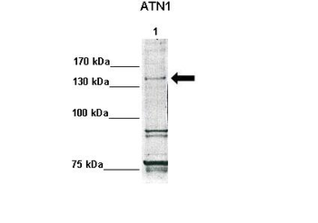 ATN1 antibody