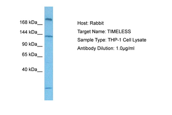 TIMELESS antibody