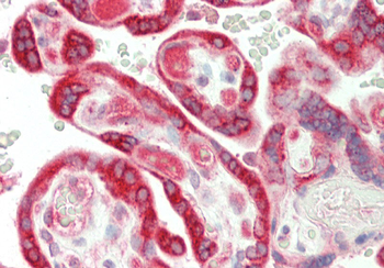 TRIP10 Rabbit Polyclonal Antibody