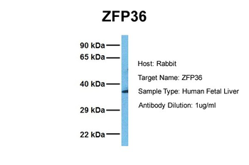 ZFP36 antibody