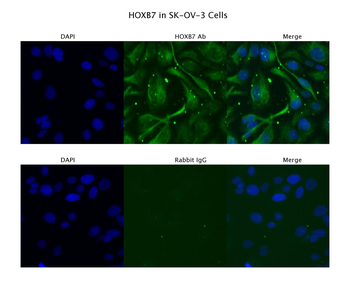 HOXB7 antibody