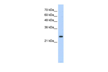 HOXB7 antibody