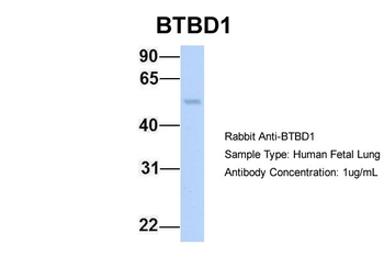 BTBD1 antibody