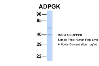 ADPGK antibody