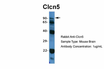 Clcn5 antibody