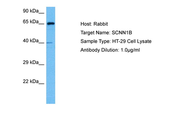 SCNN1B antibody