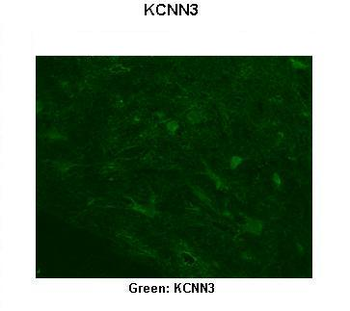 KCNN3 antibody