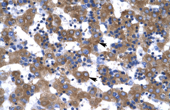 VDAC1 antibody