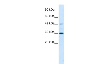 VDAC1 antibody