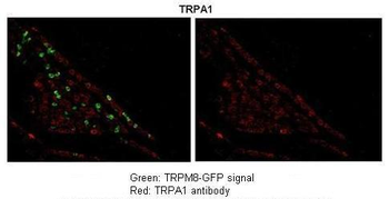 TRPA1 antibody