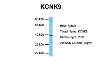 KCNK9 antibody