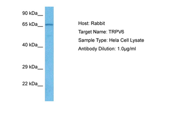 Trpv6 antibody