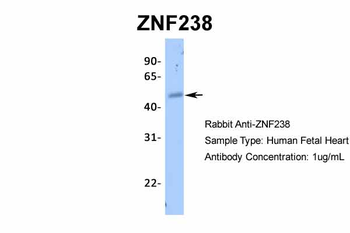 ZNF238 antibody