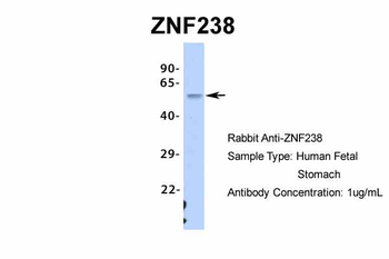 ZNF238 antibody