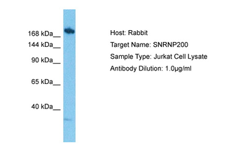 SNRNP200 antibody