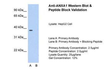 ANXA1 antibody