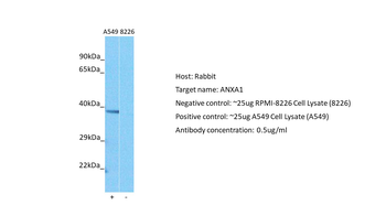 ANXA1 antibody