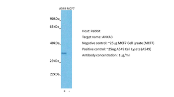 Annexin A3 antibody