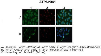 Atp6v0a1 antibody