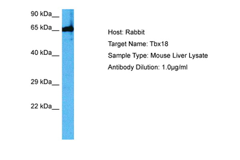 TBX18 antibody