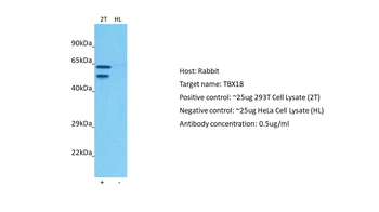 TBX18 antibody