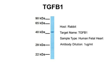 TGF beta 1 antibody