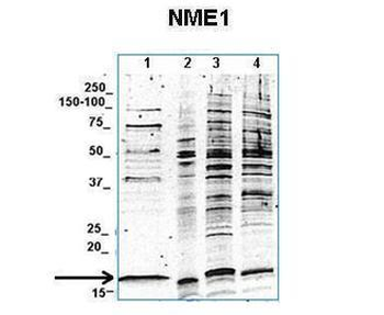 Nme1 antibody
