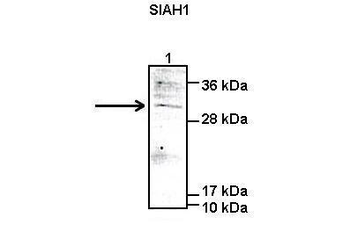 SIAH1 antibody