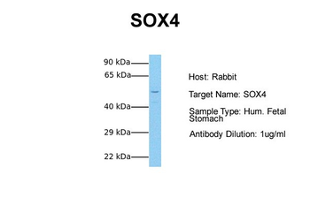SOX4 antibody