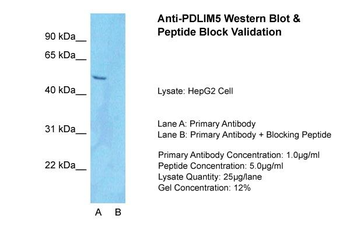PDLIM5 antibody