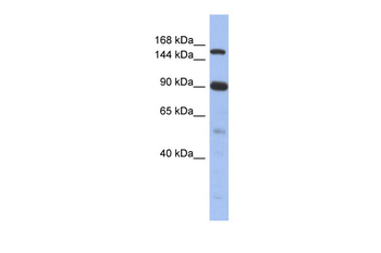 NCOA2 antibody