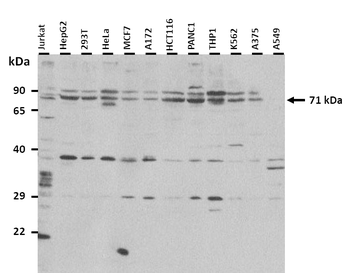 LSR Rabbit Polyclonal Antibody