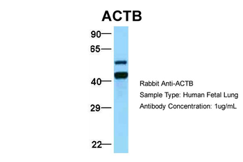 ACTB antibody