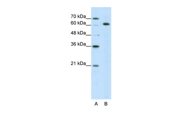 SNRP70 antibody