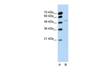 RBM22 Rabbit Polyclonal Antibody