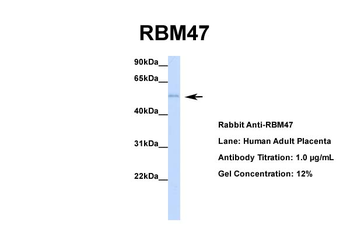 RBM47 antibody