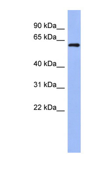 RBM47 antibody