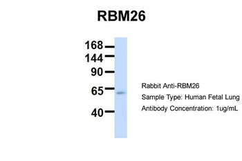 RBM26 antibody