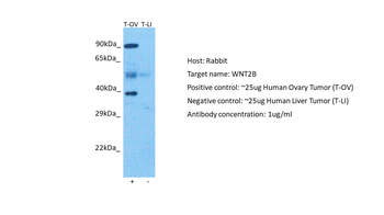 WNT2B antibody