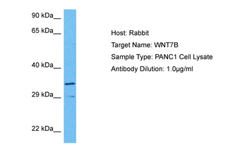 WNT7B antibody