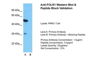 FOLR1 antibody