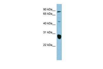 SLC26A4 antibody