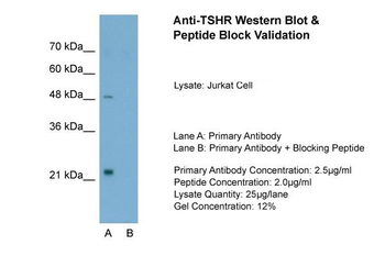 TSHR antibody