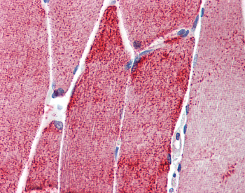 ACTN3 antibody