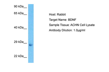 BDNF Rabbit Polyclonal Antibody