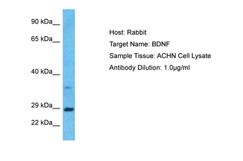 BDNF Rabbit Polyclonal Antibody